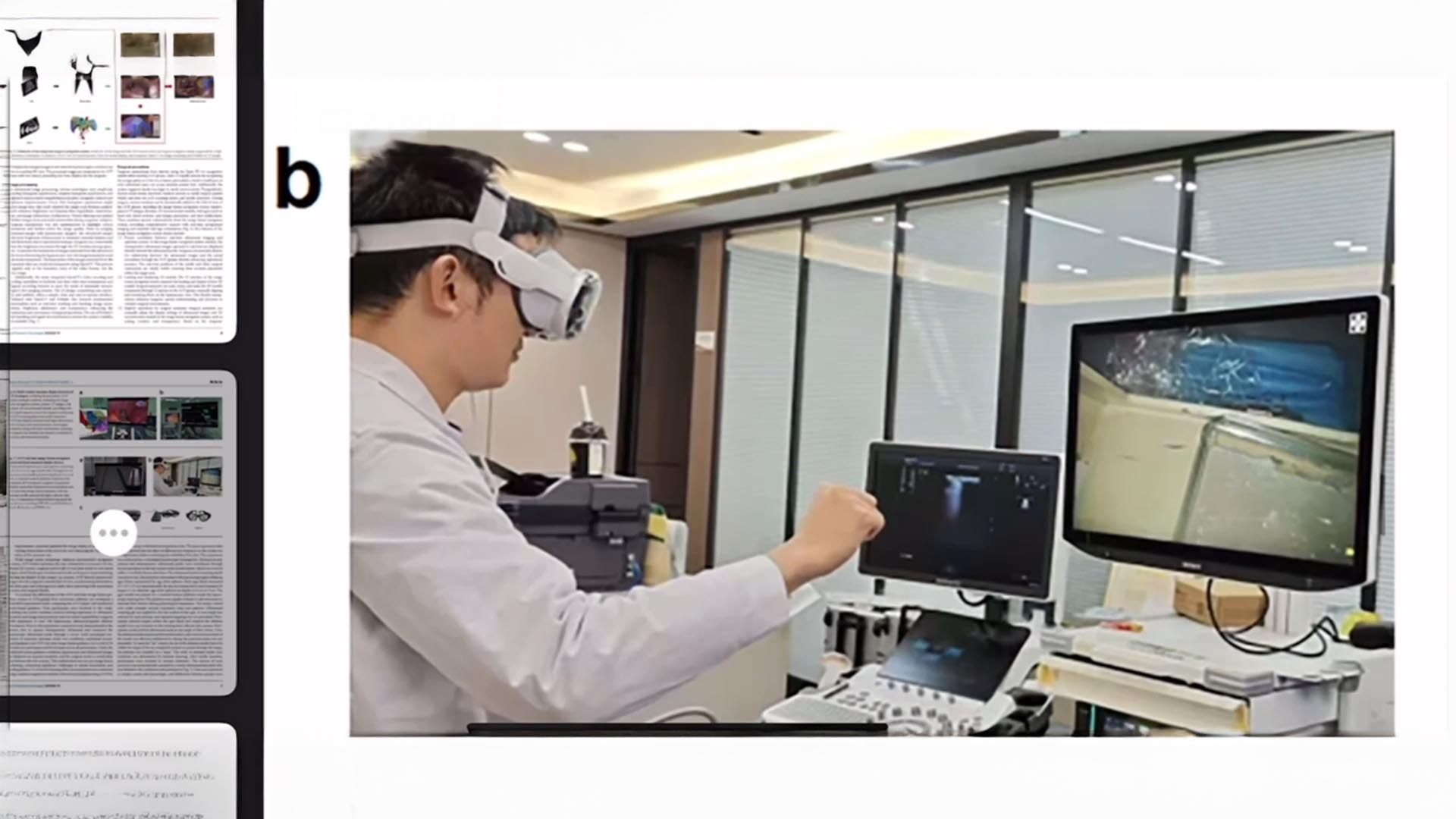 Studie zur Anwendung der Apple Vision Pro in der Leberchirurgie