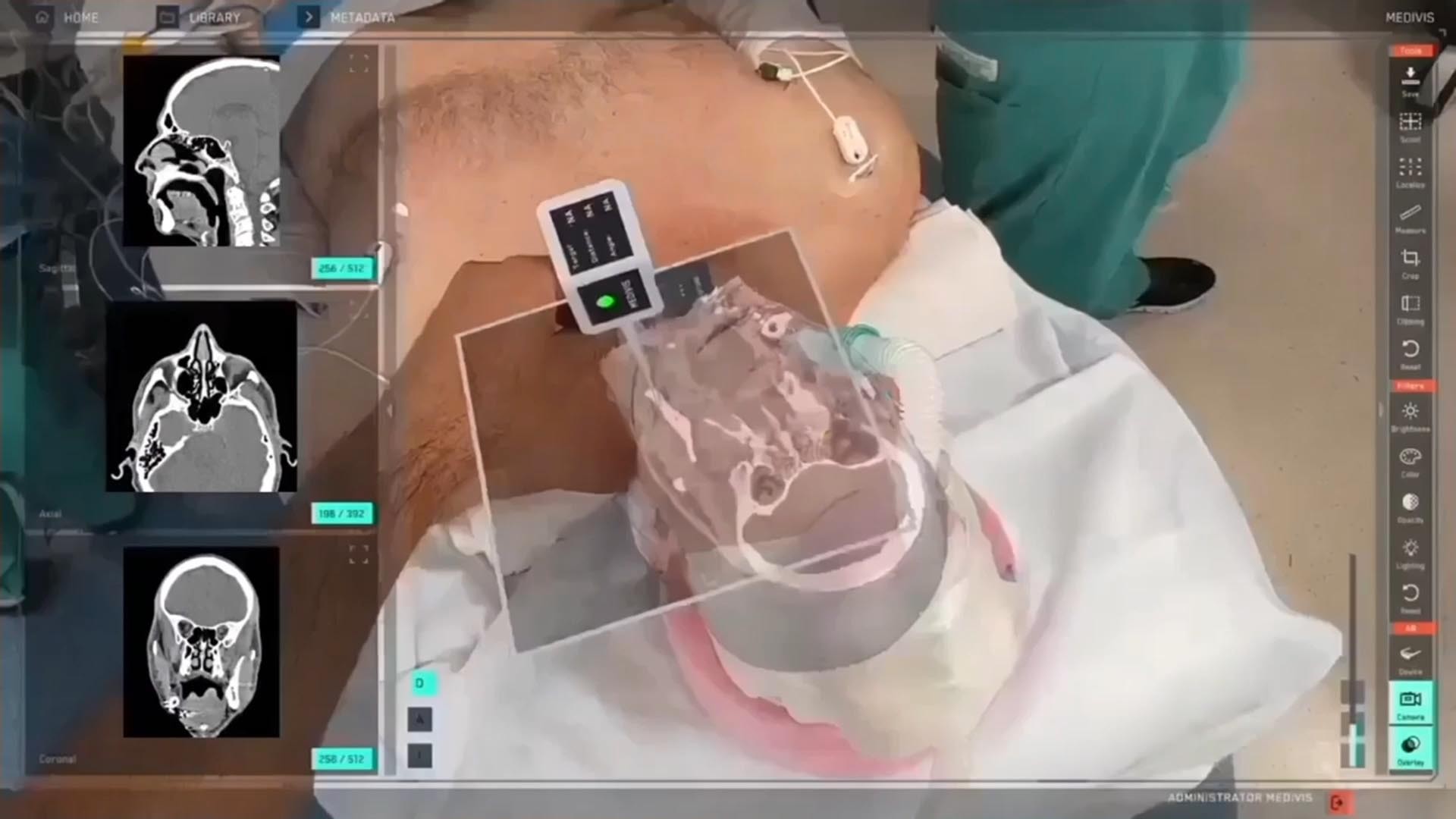 Ultraschall mit Apple Vision Pro in Echtzeit